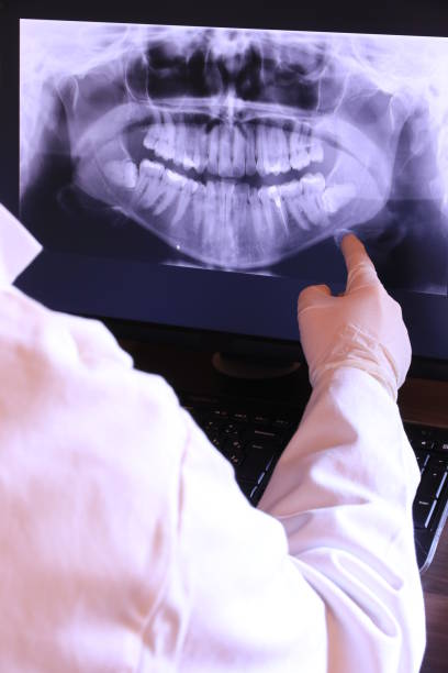 Best Emergency Dentist for Lost Fillings or Crowns in Crofton, MD