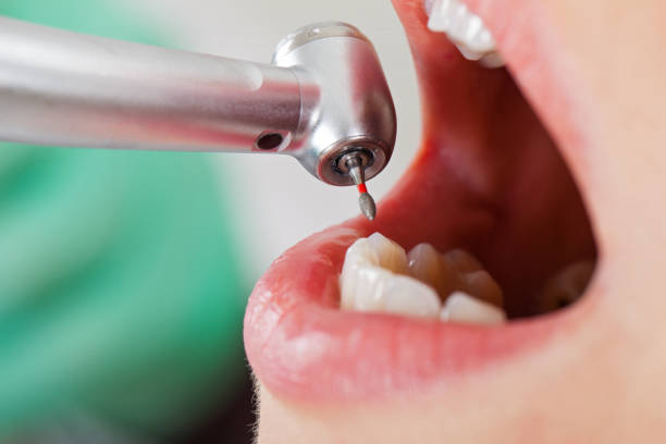Best Orthodontic Emergency Dentist in Crofton, MD